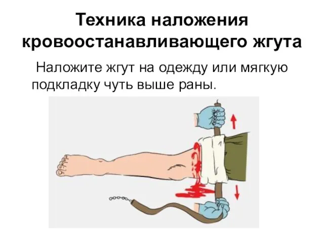 Техника наложения кровоостанавливающего жгута Наложите жгут на одежду или мягкую подкладку чуть выше раны.