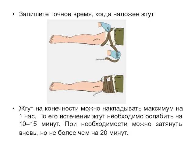 Запишите точное время, когда наложен жгут Жгут на конечности можно накладывать максимум