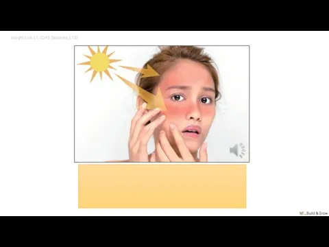 Insight Link L1 (CH3 Seasons_L10) sunburn