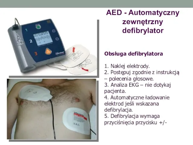 AED - Automatyczny zewnętrzny defibrylator Obsługa defibrylatora 1. Naklej elektrody. 2. Postępuj