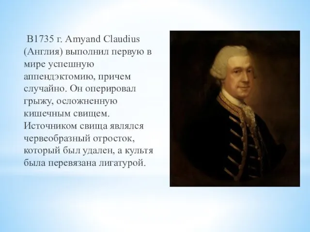 В1735 г. Amyand Claudius (Англия) выполнил первую в мире успешную аппендэктомию, причем