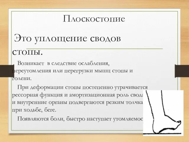 Плоскостопие Это уплощение сводов стопы. Возникает в следствие ослабления, переутомления или перегрузки