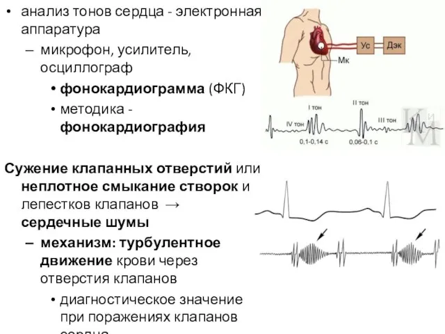 анализ тонов сердца - электронная аппаратура микрофон, усилитель, осциллограф фонокардиограмма (ФКГ) методика