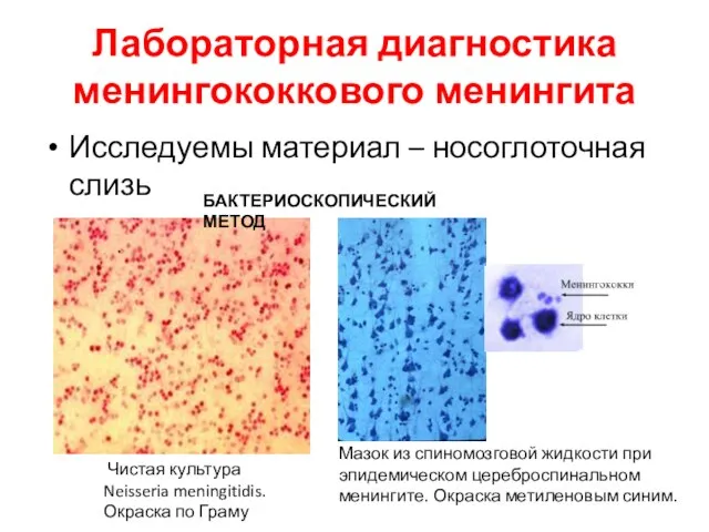 Лабораторная диагностика менингококкового менингита Исследуемы материал – носоглоточная слизь БАКТЕРИОСКОПИЧЕСКИЙ МЕТОД Чистая