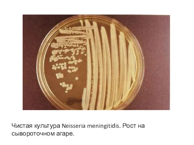 Чистая культура Neisseria meningitidis. Рост на сывороточном агаре.