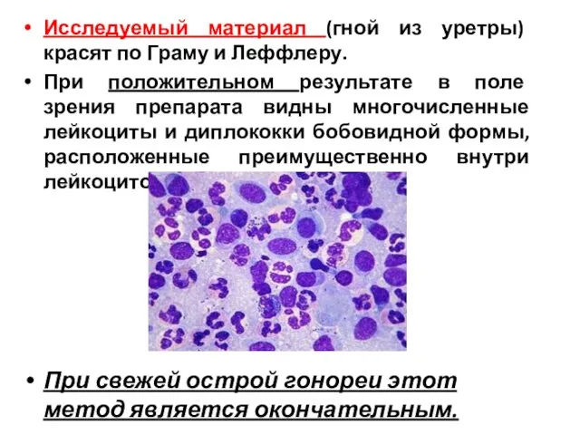 Исследуемый материал (гной из уретры) красят по Граму и Леффлеру. При положительном