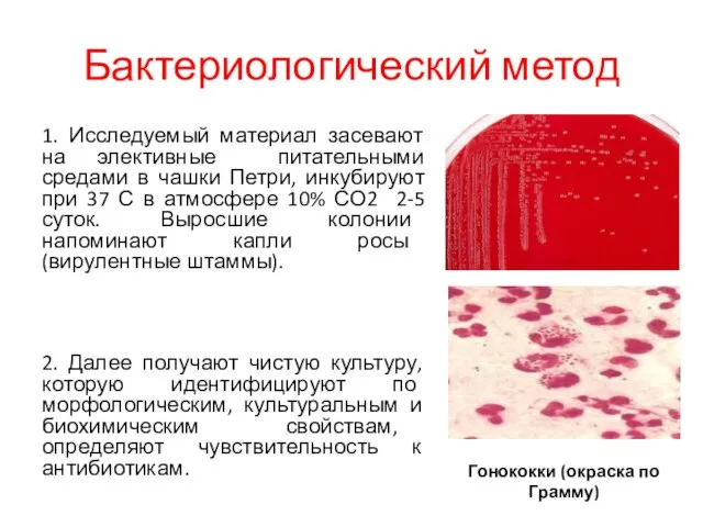 Бактериологический метод 1. Исследуемый материал засевают на элективные питательными средами в чашки