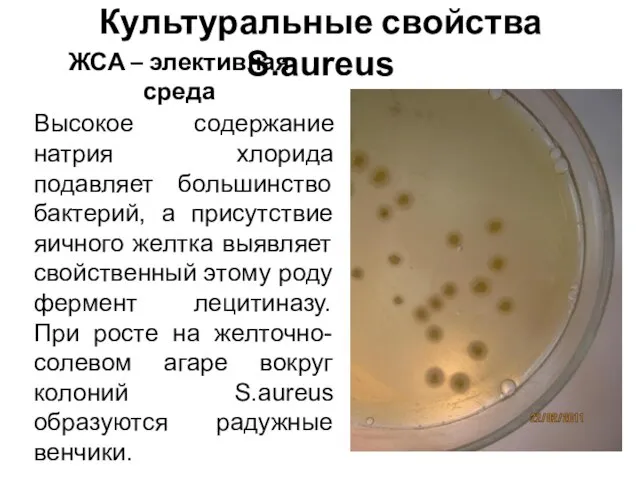 Культуральные свойства S.aureus ЖСА – элективная среда Высокое содержание натрия хлорида подавляет