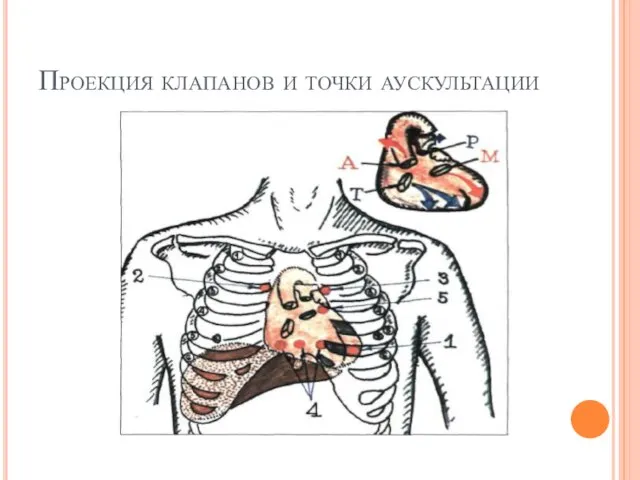 Проекция клапанов и точки аускультации