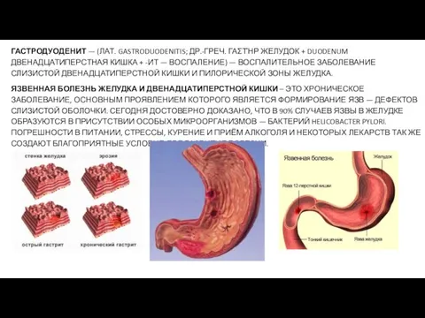 ГАСТРОДУОДЕНИТ — (ЛАТ. GASTRODUODENITIS; ДР.-ГРЕЧ. ΓΑΣΤΉΡ ЖЕЛУДОК + DUODENUM ДВЕНАДЦАТИПЕРСТНАЯ КИШКА +