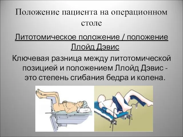 Положение пациента на операционном столе Литотомическое положение / положение Ллойд Дэвис Ключевая