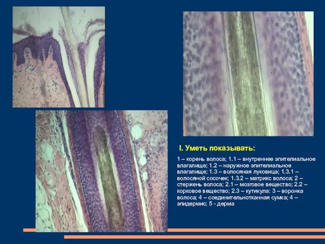 1 – корень волоса; 1.1 – внутреннее эпителиальное влагалище; 1.2 – наружное