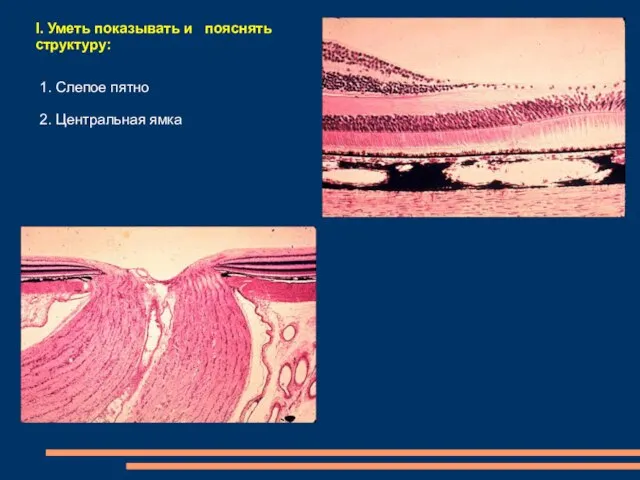 I. Уметь показывать и пояснять структуру: 1. Слепое пятно 2. Центральная ямка