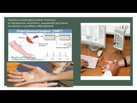 Электромиография может помочь в установлении миотонии, мышечной дистонии, склероза и подобных заболеваний.