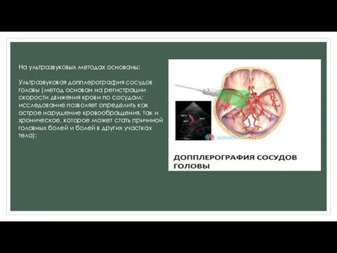 На ультразвуковых методах основаны: Ультразвуковая допплерография сосудов головы (метод основан на регистрации