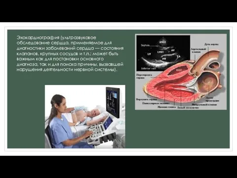 Эхокардиография (ультразвуковое обследование сердца, применяемое для диагностики заболеваний сердца — состояния клапанов,