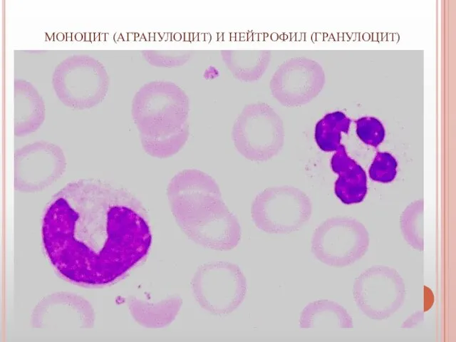 МОНОЦИТ (АГРАНУЛОЦИТ) И НЕЙТРОФИЛ (ГРАНУЛОЦИТ)