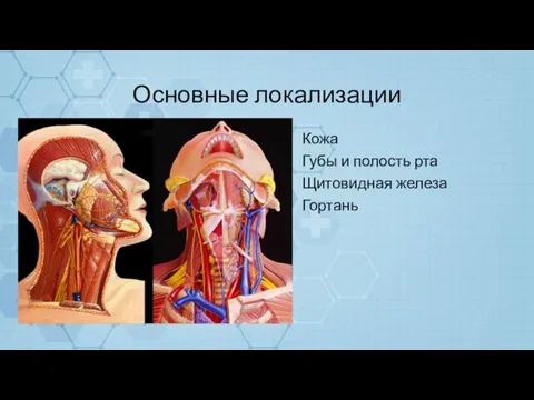 Основные локализации Кожа Губы и полость рта Щитовидная железа Гортань