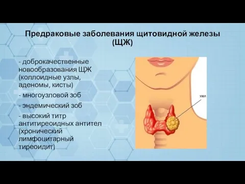 Предраковые заболевания щитовидной железы (ЩЖ) - доброкачественные новообразования ЩЖ (коллоидные узлы, аденомы,