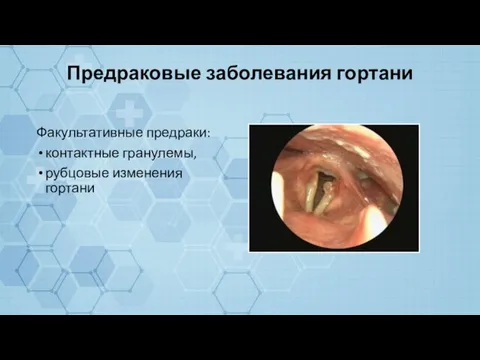 Предраковые заболевания гортани Факультативные предраки: контактные гранулемы, рубцовые изменения гортани