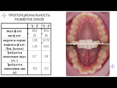 ПРОПОРЦИОНАЛЬНОСТЬ РАЗМЕРОВ ЗУБОВ
