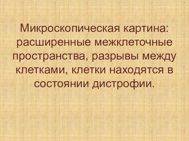 Микроскопическая картина: расширенные межклеточные пространства, разрывы между клетками, клетки находятся в состоянии дистрофии.