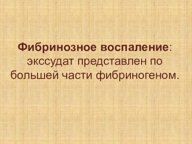 Фибринозное воспаление: экссудат представлен по большей части фибриногеном.