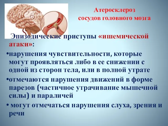 Атеросклероз сосудов головного мозга Эпизодические приступы «ишемической атаки»: нарушения чувствительности, которые могут