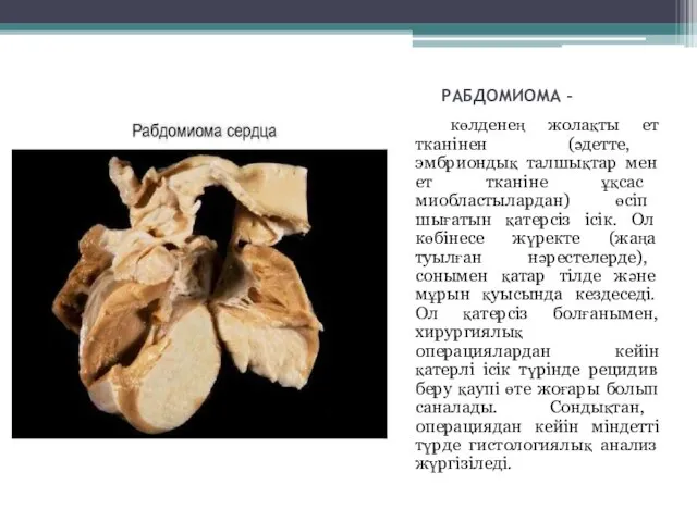 РАБДОМИОМА - көлденең жолақты ет тканінен (әдетте, эмбриондық талшықтар мен ет тканіне