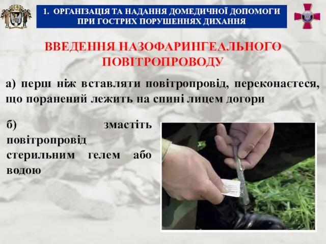 ВВЕДЕННЯ НАЗОФАРИНГЕАЛЬНОГО ПОВІТРОПРОВОДУ а) перш ніж вставляти повітропровід, переконаєтеся, що поранений лежить на спині лицем догори