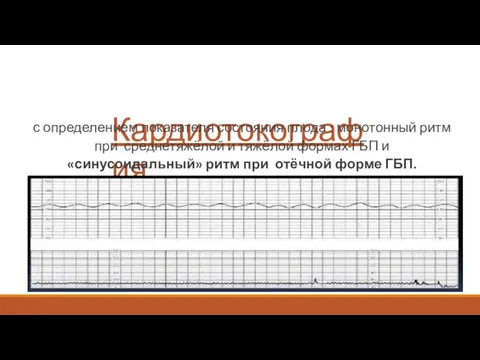 Кардиотокография с определением показателя состояния плода : монотонный ритм при среднетяжёлой и