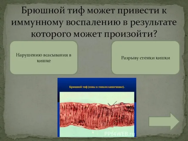 Брюшной тиф может привести к иммунному воспалению в результате которого может произойти?