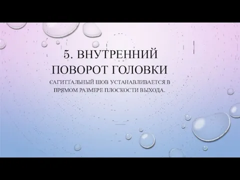 5. ВНУТРЕННИЙ ПОВОРОТ ГОЛОВКИ САГИТТАЛЬНЫЙ ШОВ УСТАНАВЛИВАЕТСЯ В ПРЯМОМ РАЗМЕРЕ ПЛОСКОСТИ ВЫХОДА.