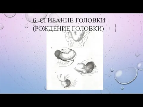 6. СГИБАНИЕ ГОЛОВКИ (РОЖДЕНИЕ ГОЛОВКИ)