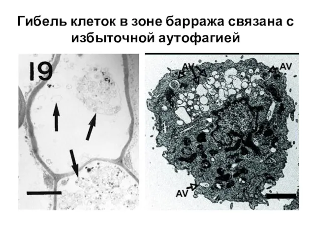 Гибель клеток в зоне барража связана с избыточной аутофагией