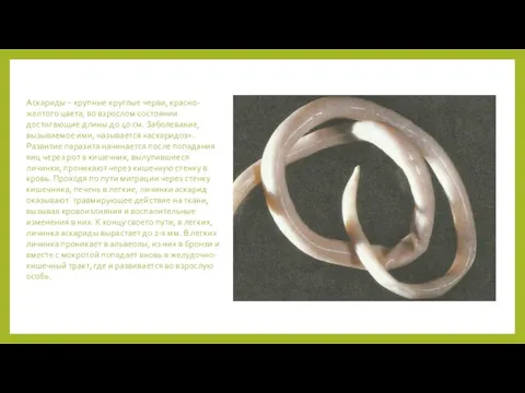 Аскариды – крупные круглые черви, красно-желтого цвета, во взрослом состоянии достигающие длины