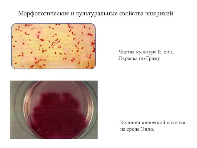 Чистая культура Е. coli. Окраска по Граму Колонии кишечной палочки на среде