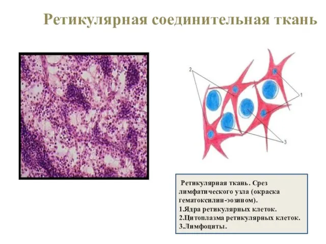 Ретикулярная соединительная ткань Ретикулярная ткань. Срез лимфатического узла (окраска гематоксилин-эозином). 1.Ядра ретикулярных