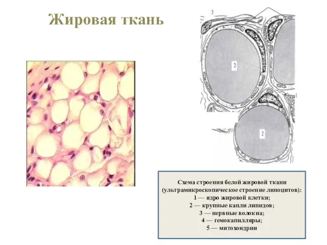 Жировая ткань Схема строения белой жировой ткани (ультрамикроскопическое строение липоцитов): 1 —