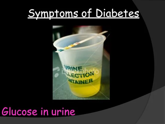 Symptoms of Diabetes Glucose in urine