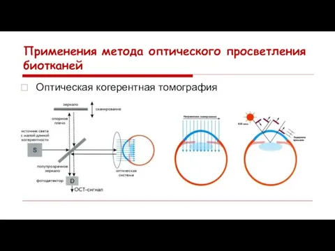 Применения метода оптического просветления биотканей Оптическая когерентная томография