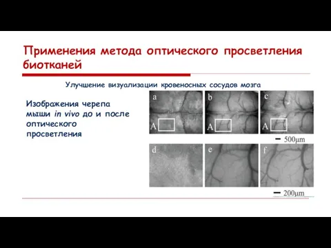 Применения метода оптического просветления биотканей Улучшение визуализации кровеносных сосудов мозга Изображения черепа