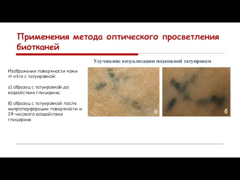 Применения метода оптического просветления биотканей Улучшение визуализации подкожной татуировки Изображения поверхности кожи