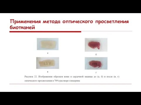 Применения метода оптического просветления биотканей