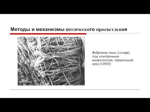 Методы и механизмы оптического просветления Фиброзная ткань (склера) под электронным микроскопом, продольный срез (×2900)