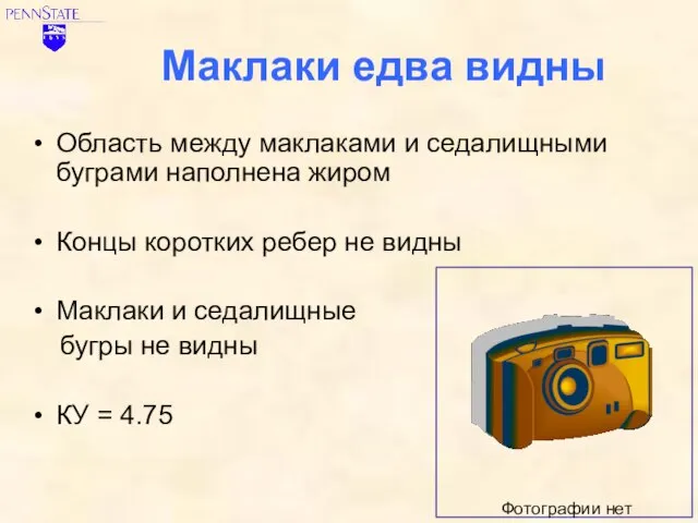 Маклаки едва видны Область между маклаками и седалищными буграми наполнена жиром Концы