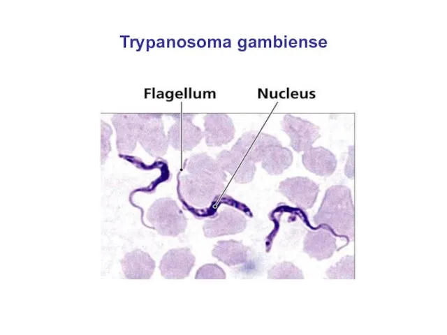 Trypanosoma gambiense