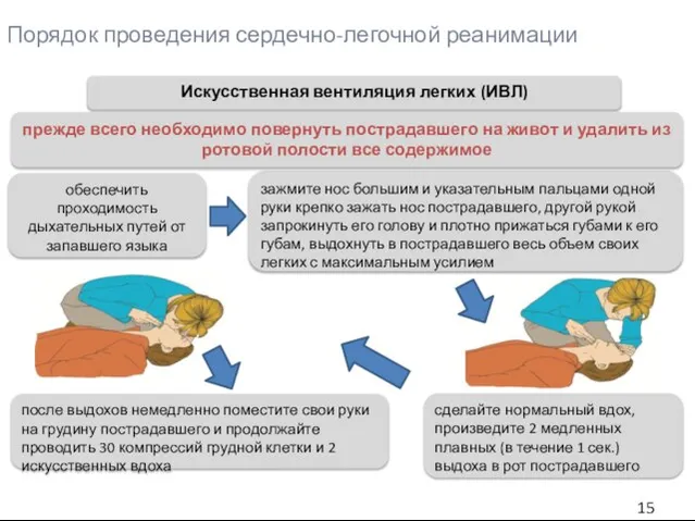 Порядок проведения сердечно-легочной реанимации Искусственная вентиляция легких (ИВЛ) зажмите нос большим и