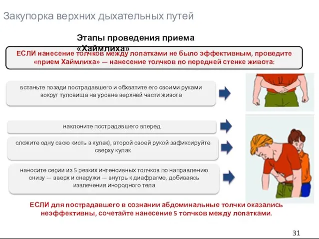 Закупорка верхних дыхательных путей ЕСЛИ нанесение толчков между лопатками не было эффективным,