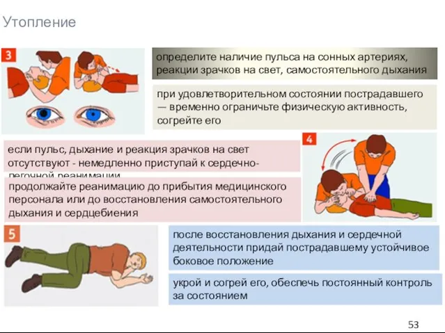 Утопление определите наличие пульса на сонных артериях, реакции зрачков на свет, самостоятельного